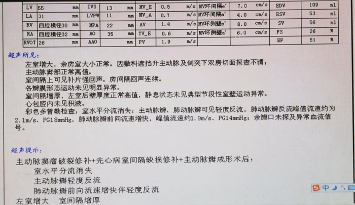 惊心动魄胸心外科成功为先天性心脏病患者保留主动脉瓣膜